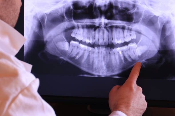 Best After-Hours Emergency Dentist in Solon, IA