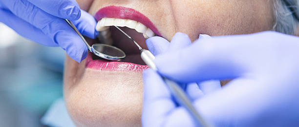 Best Emergency Tooth Extraction in Solon, IA